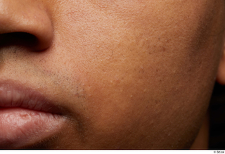 HD Face skin Javion Norris cheek face lips mouth skin…